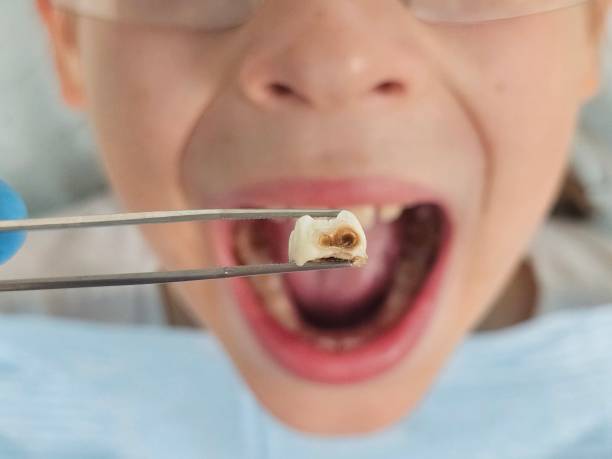 Best Tooth Pain Emergency Relief  in Italy, TX